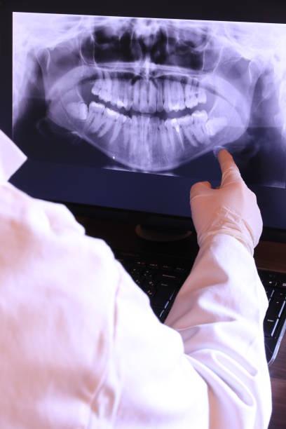 Best Emergency Treatment for Dental Infections or Abscesses in San Felipe Pueblo, NM