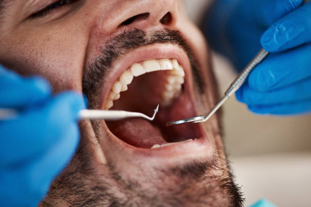 Best Emergency Gum Treatment in San Felipe Pueblo, NM